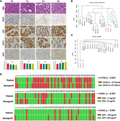 Patient-Derived Xenograft Models for Intrahepatic Cholangiocarcinoma and Their Application in Guiding Personalized Medicine